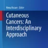 Cutaneous Cancers: An Interdisciplinary Approach :