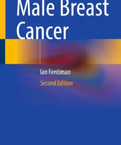 Male Breast Cancer :