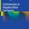 Controversies in Hepatocellular Carcinoma :