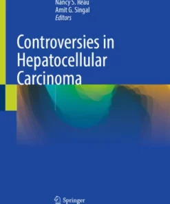 Controversies in Hepatocellular Carcinoma :