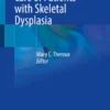 Anesthesia Care of Patients with Skeletal Dysplasia :