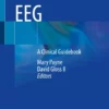 Neonatal EEG : A Clinical Guidebook
