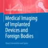 Medical Imaging of Implanted Devices and Foreign Bodies : Head, Extremities and Spine