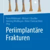 Periimplantäre Frakturen :