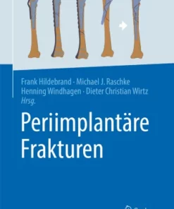 Periimplantäre Frakturen :