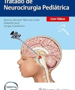 Tratado de Neurocirurgia Pediátrica (Portuguese Edition) (EPUB)