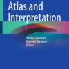 Neonatal EEG: Atlas and Interpretation :