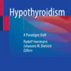 Hypothyroidism : A Paradigm Shift