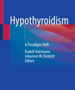Hypothyroidism : A Paradigm Shift