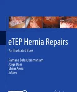 eTEP Hernia Repairs : An Illustrated Book