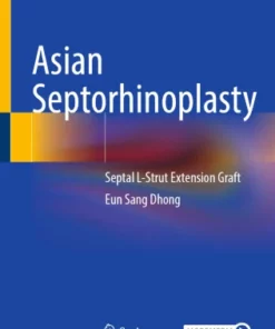 Asian Septorhinoplasty : Septal L-Strut Extension Graft