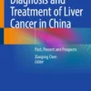 Diagnosis and Treatment of Liver Cancer in China : Past, Present and Prospects