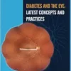 Diabetes and the Eye: Latest Concepts and Practices (Diabetes: Current and Future Developments) (EPUB)