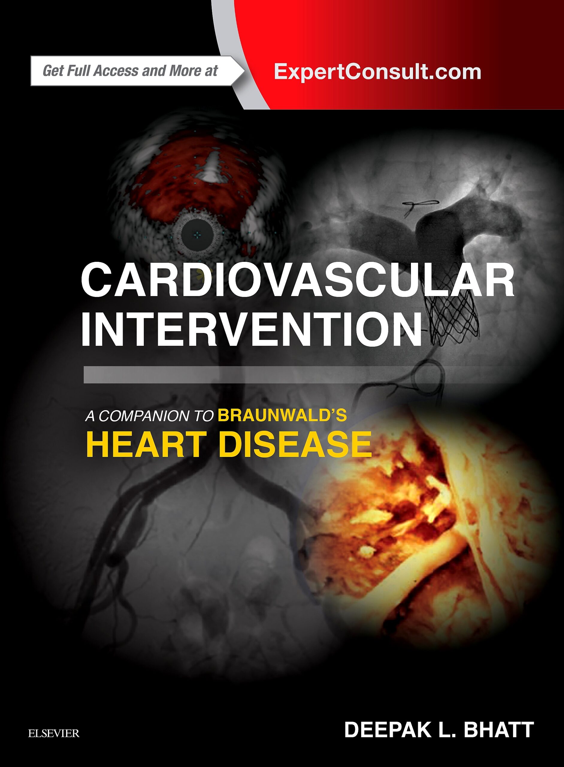 Cardiovascular Intervention: A Companion to Braunwald’s Heart Disease (EPUB) Cardiovascular Intervention: A Companion to Braunwald’s Heart Disease (EPUB)