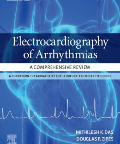 Electrocardiography of Arrhythmias: A Comprehensive Review: A Companion to Cardiac Electrophysiology, 2nd Edition (EPUB)