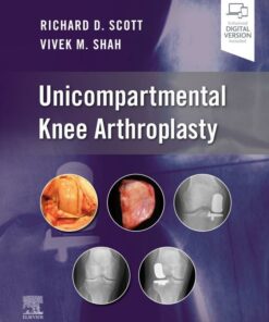 Unicompartmental Knee Arthroplasty (EPUB)