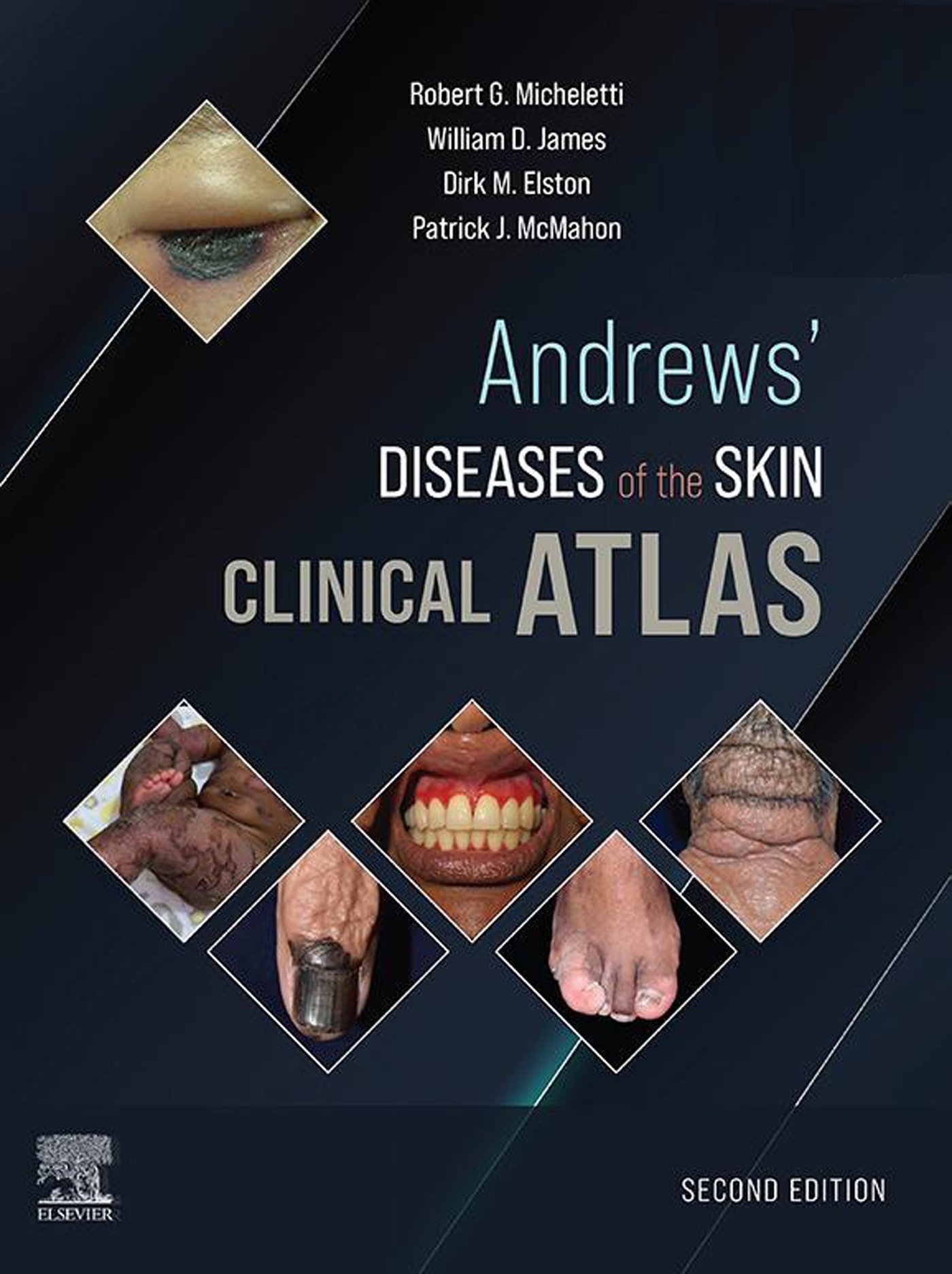 Andrews’ Diseases of the Skin Clinical Atlas, 2nd Edition (EPUB) Andrews’ Diseases of the Skin Clinical Atlas, 2nd Edition (EPUB)
