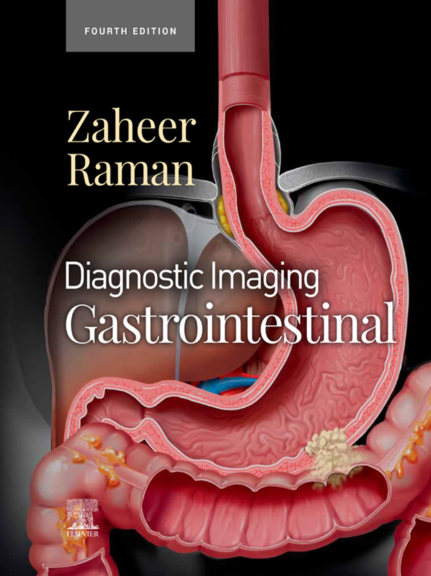 Diagnostic Imaging: Gastrointestinal, 4th Edition (EPUB) Diagnostic Imaging: Gastrointestinal, 4th Edition (EPUB)