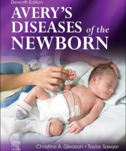 Avery’s Diseases of the Newborn, 11th Edition (EPUB)