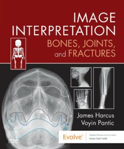 Image Interpretation: Bones, Joints, and Fractures (EPUB)