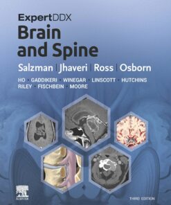 ExpertDDx: Brain and Spine, 3rd Edition (EPUB)