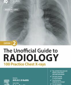 The Unofficial Guide to Radiology: 100 Practice Chest X-rays, 2nd Edition (EPUB)