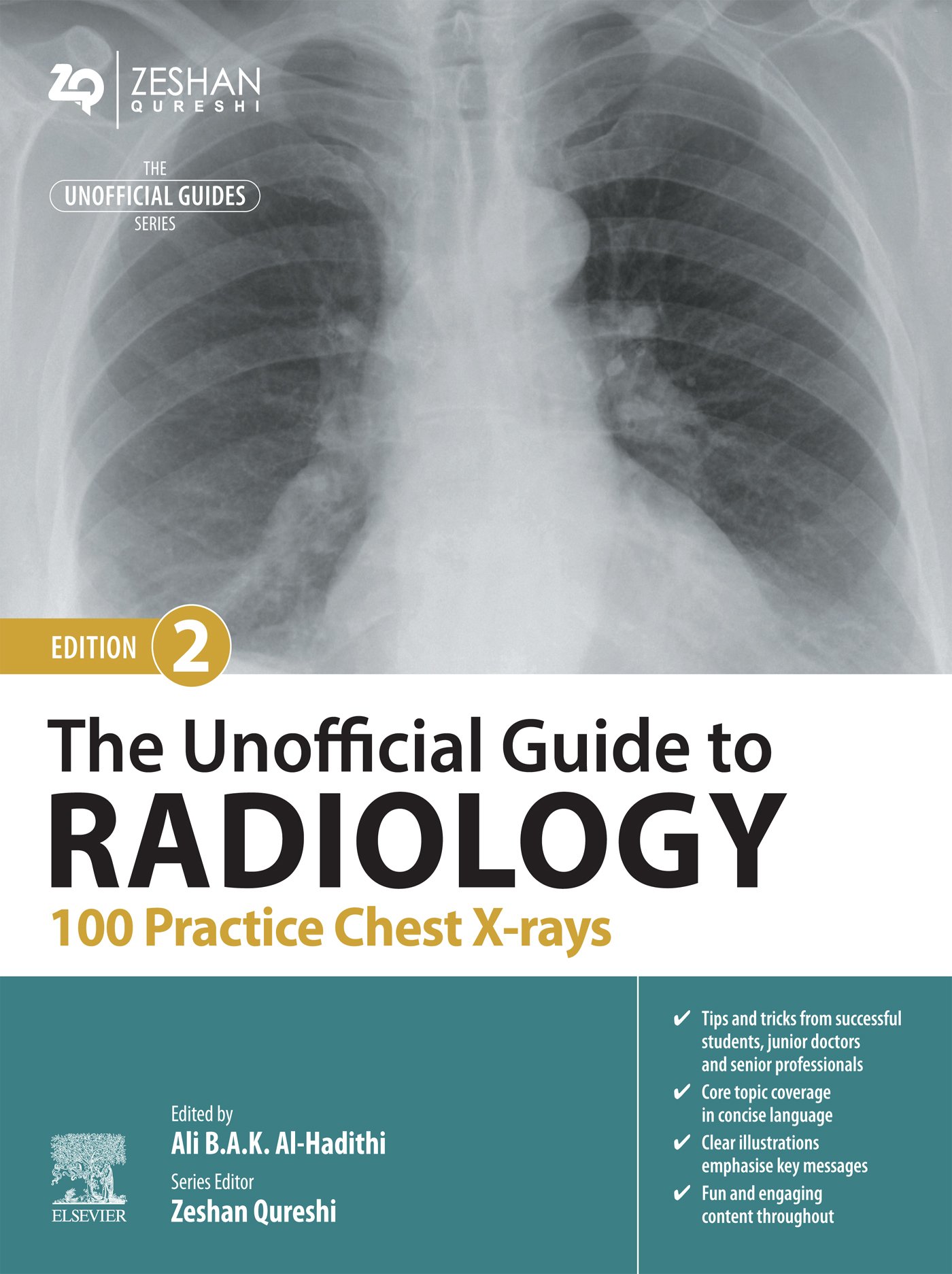The Unofficial Guide to Radiology: 100 Practice Chest X-rays, 2nd Edition (EPUB) The Unofficial Guide to Radiology: 100 Practice Chest X-rays, 2nd Edition (EPUB)