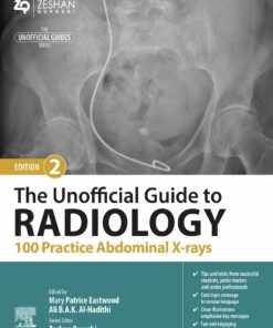 The Unofficial Guide to Radiology: 100 Practice Abdominal X-rays, 2nd Edition (EPUB)