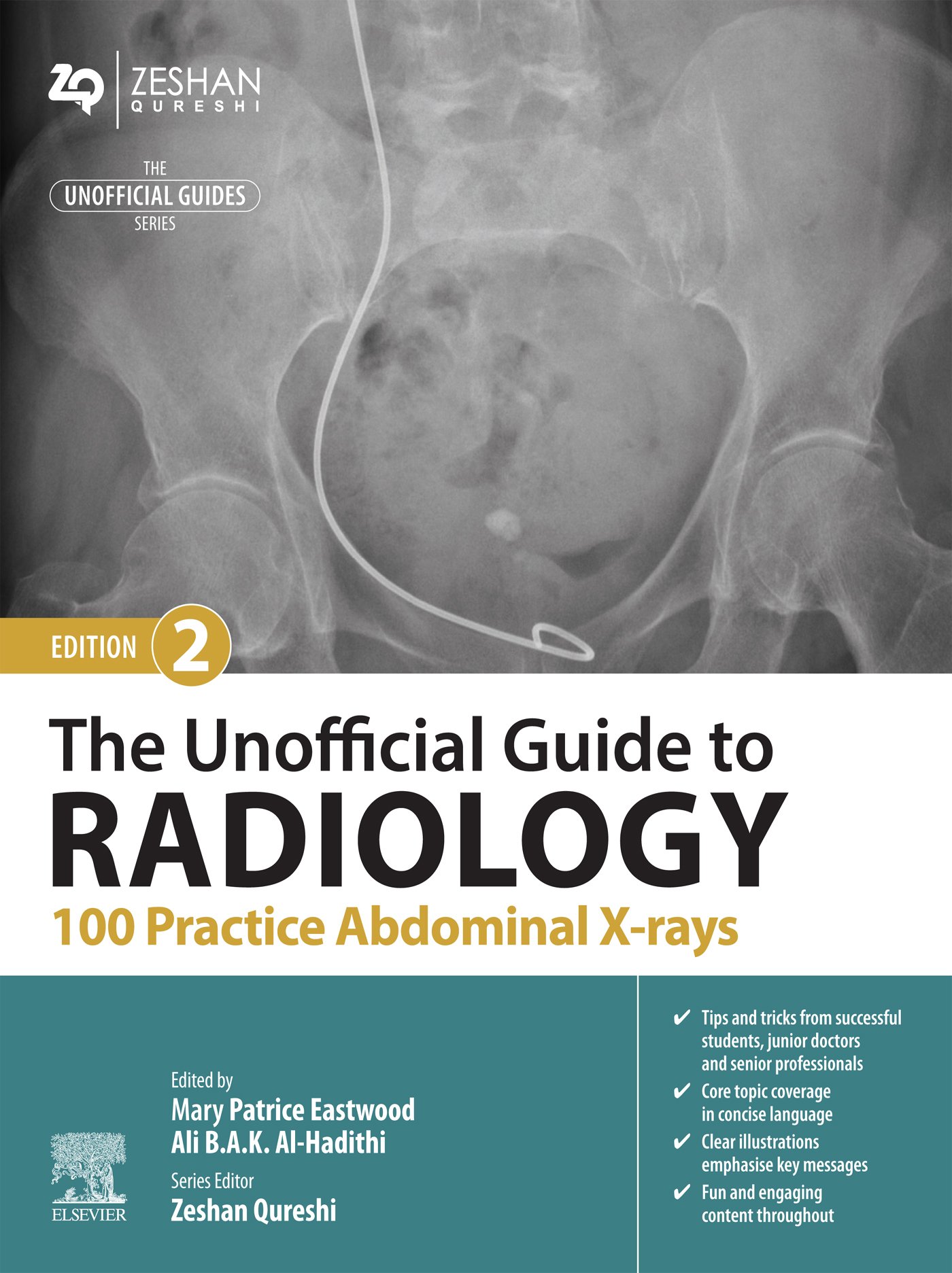 The Unofficial Guide to Radiology: 100 Practice Abdominal X-rays, 2nd Edition (EPUB) The Unofficial Guide to Radiology: 100 Practice Abdominal X-rays, 2nd Edition (EPUB)