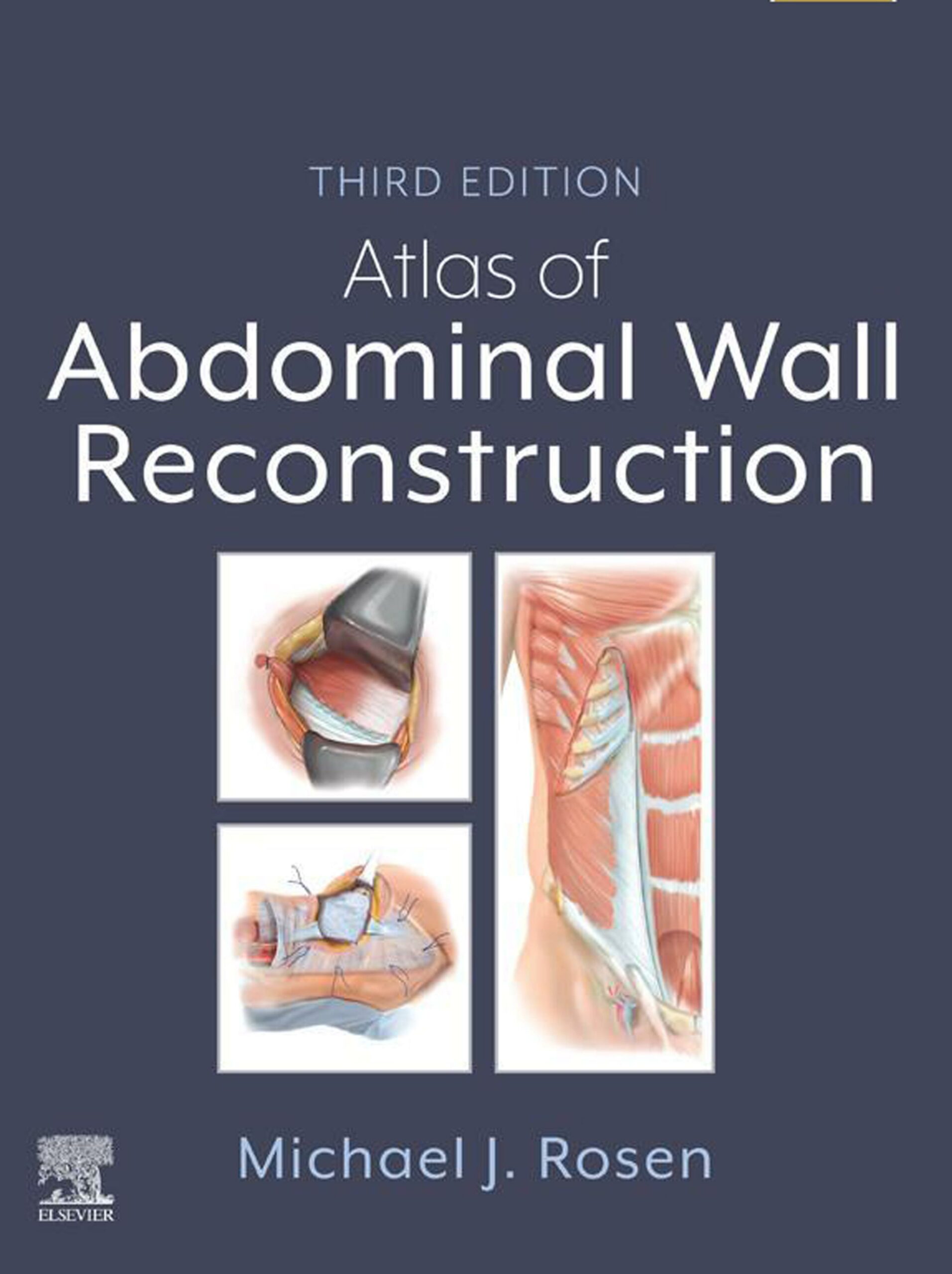 Atlas of Abdominal Wall Reconstruction, 3rd Edition (PDF) Atlas of Abdominal Wall Reconstruction, 3rd Edition (PDF)