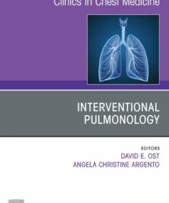 Interventional Pulmonology, An Issue of Clinics in Chest Medicine (EPUB)