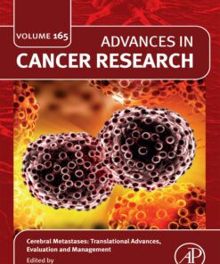 Cerebral Metastases: Translational Advances, Evaluation and Management (PDF)