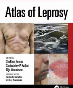 Atlas of Leprosy (EPUB)