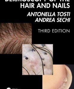 Dermoscopy of the Hair and Nails, 3rd Edition (EPUB)