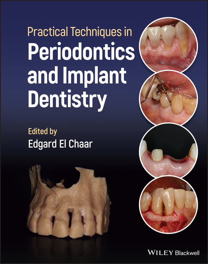 Practical Techniques in Periodontics and Implant Dentistry (EPUB) Practical Techniques in Periodontics and Implant Dentistry (EPUB)