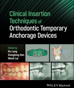 Clinical Insertion Techniques of Orthodontic Temporary Anchorage Devices (EPUB)