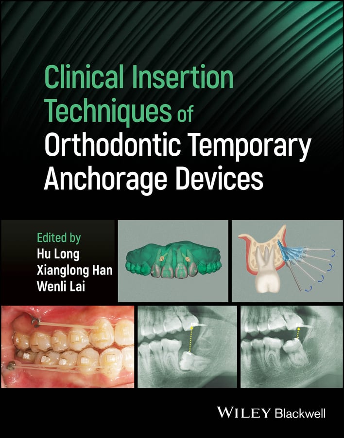 Clinical Insertion Techniques of Orthodontic Temporary Anchorage Devices (EPUB) Clinical Insertion Techniques of Orthodontic Temporary Anchorage Devices (EPUB)