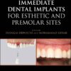 Immediate Dental Implants for Esthetic and Premolar Sites (EPUB) Immediate Dental Implants for Esthetic and Premolar Sites (EPUB)
