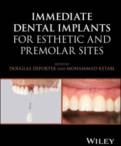 Immediate Dental Implants for Esthetic and Premolar Sites (EPUB)