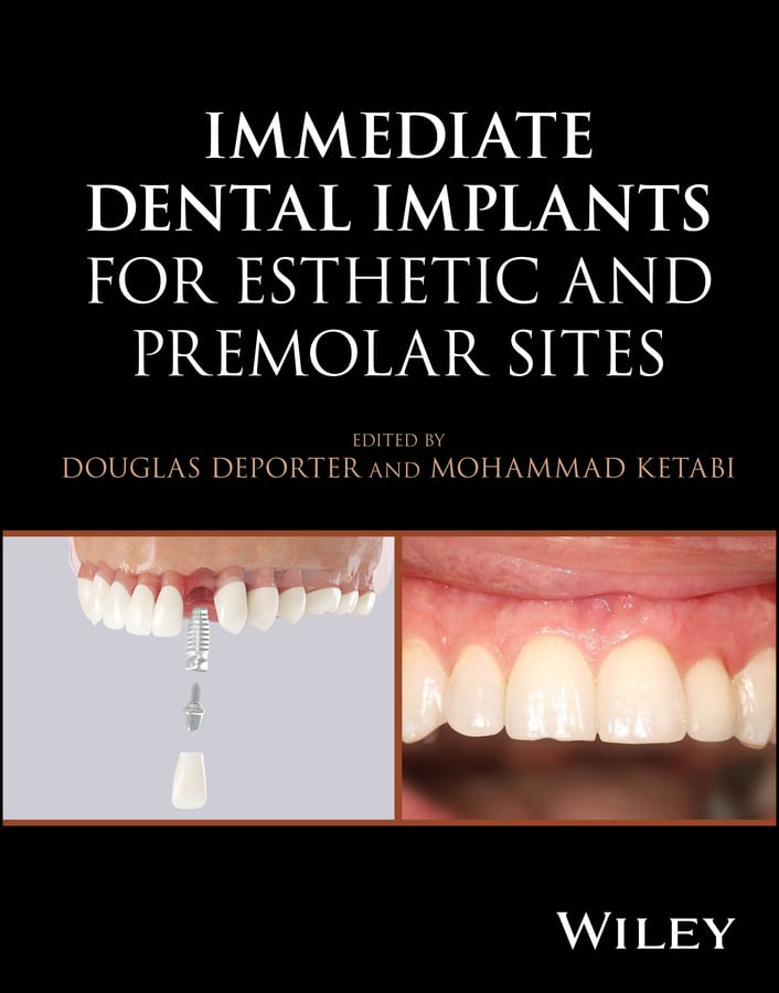 Immediate Dental Implants for Esthetic and Premolar Sites (EPUB) Immediate Dental Implants for Esthetic and Premolar Sites (EPUB)