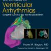The Origins of Ventricular Arrhythmias: Using the ECG as a Key Tool for Localization (EPUB)