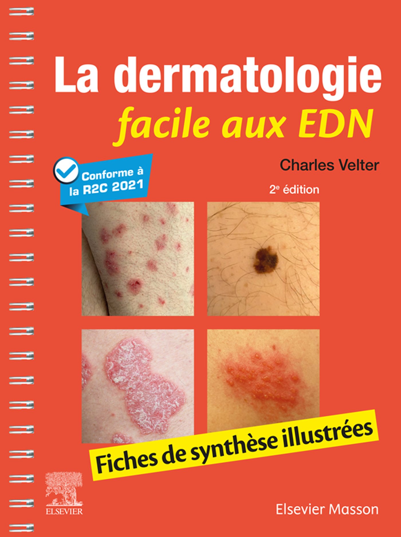 La dermatologie facile aux EDN: Fiches de synthèse illustrées, 2nd Edition (EPUB) La dermatologie facile aux EDN: Fiches de synthèse illustrées, 2nd Edition (EPUB)