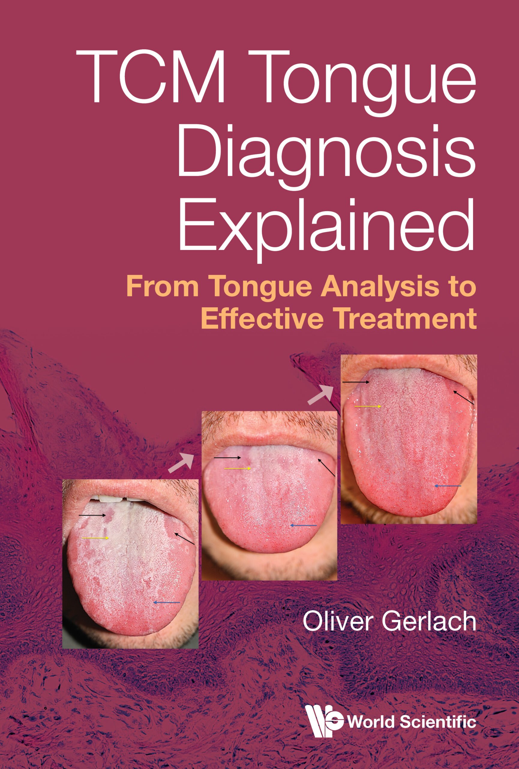 Tcm Tongue Diagnosis Explained: From Tongue Analysis To Effective Treatment (EPUB) Tcm Tongue Diagnosis Explained: From Tongue Analysis To Effective Treatment (EPUB)