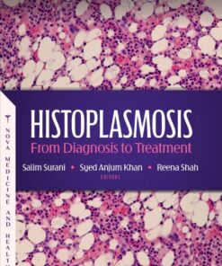 Histoplasmosis: From Diagnosis to Treatment (PDF)