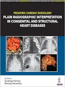 Pediatric Cardiac Radiology: Plain Radiographic Interpretation in Congenital and Structural Heart Diseases (PDF)