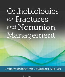 Orthobiologics for Fractures and Nonunion Management (EPUB)