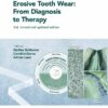 Erosive Tooth Wear: From Diagnosis to Therapy, 3rd Edition (EPUB)
