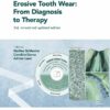 Erosive Tooth Wear: From Diagnosis to Therapy, 3rd Edition (PDF)
