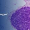 Breast Pathology – The Pathology of Neoplastic Diseases 2025 (Videos with subtitles + Slides)