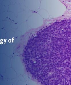 Breast Pathology – The Pathology of Neoplastic Diseases 2025 (Videos with subtitles + Slides)